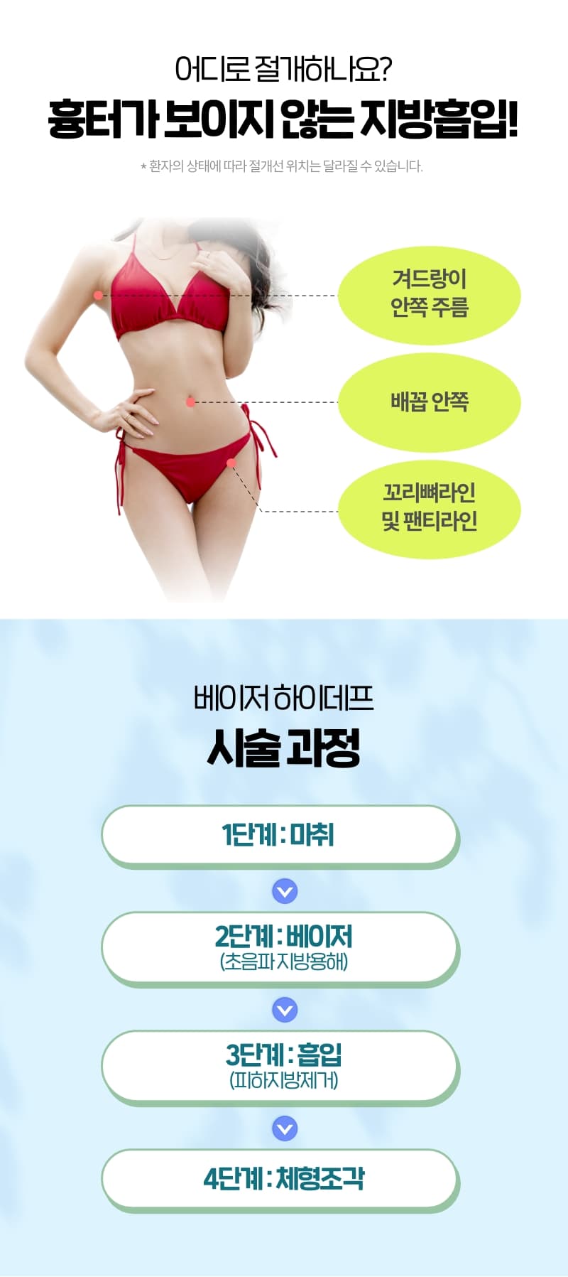 상세 이미지